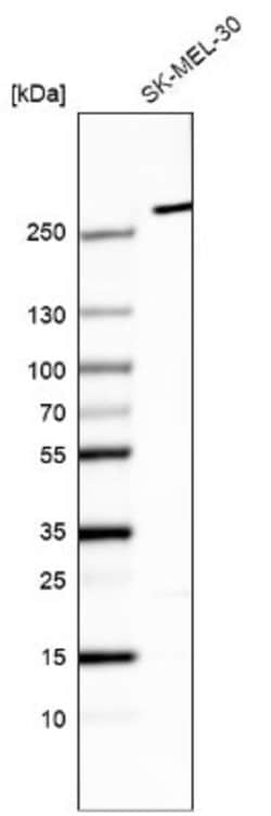 myosin X Antibody (CL9025), Novus Biologicals 100 &mu;L; Unconjugated:Antibodies,